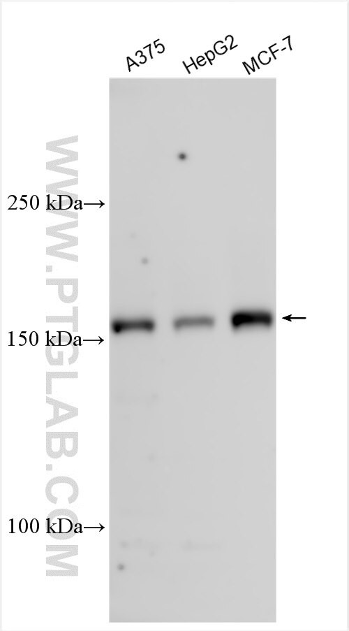 KDM5B Antibody in Western Blot (WB)
