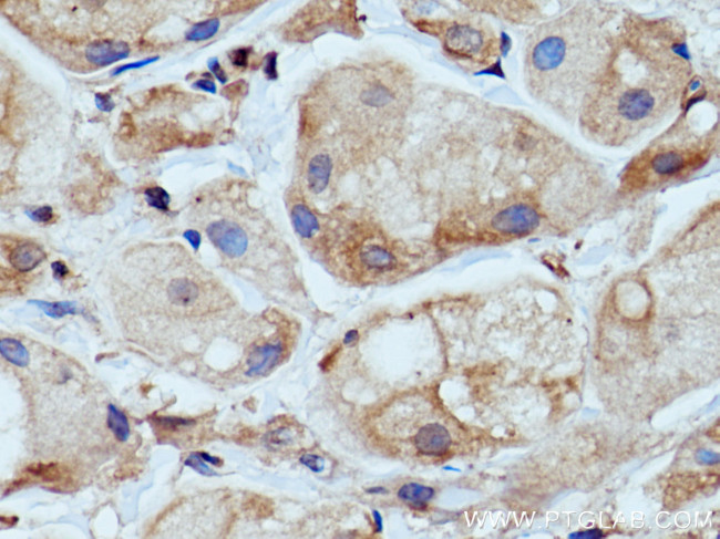 WNK1 Antibody in Immunohistochemistry (Paraffin) (IHC (P))