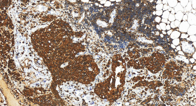 UNC93B1 Antibody in Immunohistochemistry (Paraffin) (IHC (P))