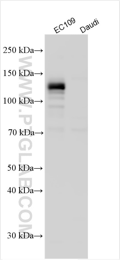 CARD14 Antibody in Western Blot (WB)