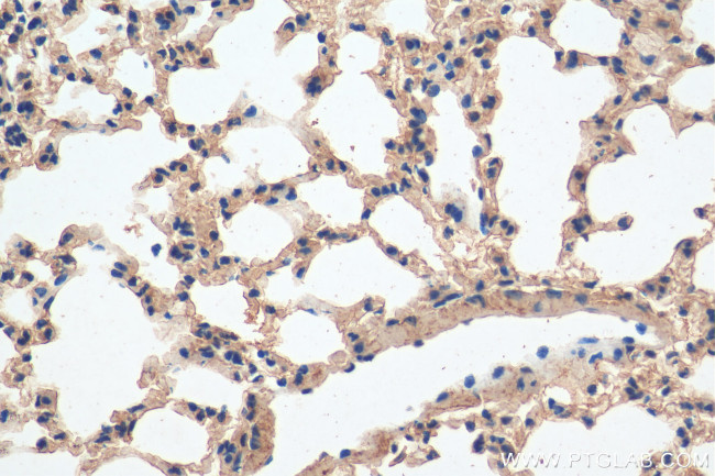 Integrin beta-6 Antibody in Immunohistochemistry (Paraffin) (IHC (P))