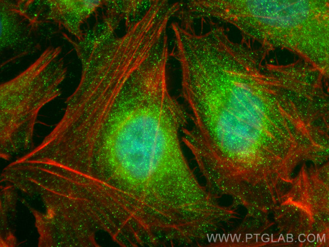 KAT2A/GCN5 Antibody in Immunocytochemistry (ICC/IF)