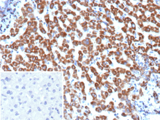 Angiopoietin/ANGPT1 Antibody in Immunohistochemistry (Paraffin) (IHC (P))