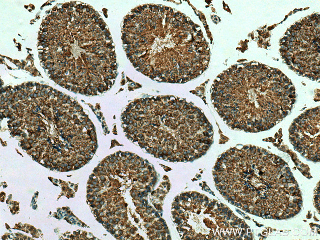 MSTO1 Antibody in Immunohistochemistry (Paraffin) (IHC (P))