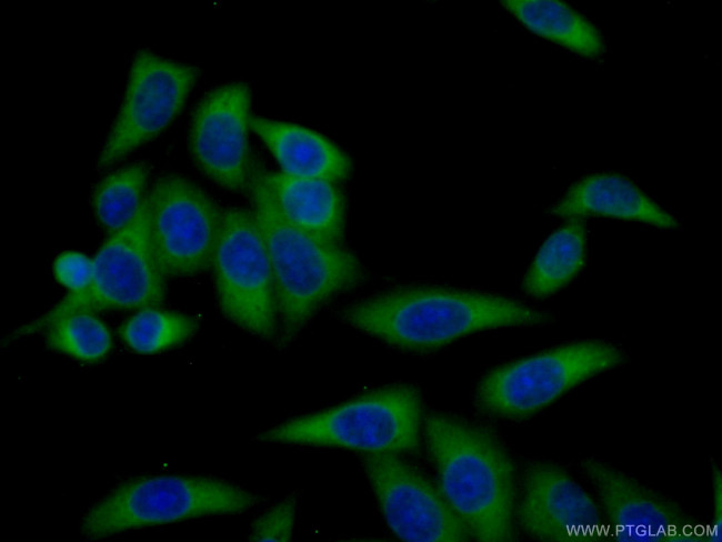 ARHGAP18 Antibody in Immunocytochemistry (ICC/IF)