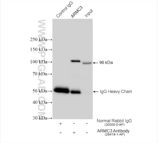 ARMC3 Antibody in Immunoprecipitation (IP)