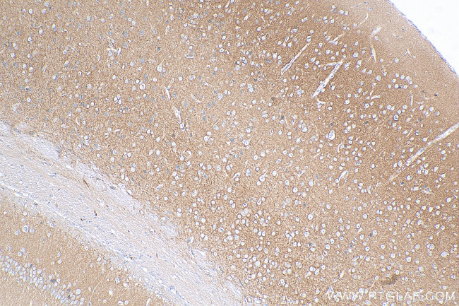 PMCA2 Antibody in Immunohistochemistry (Paraffin) (IHC (P))