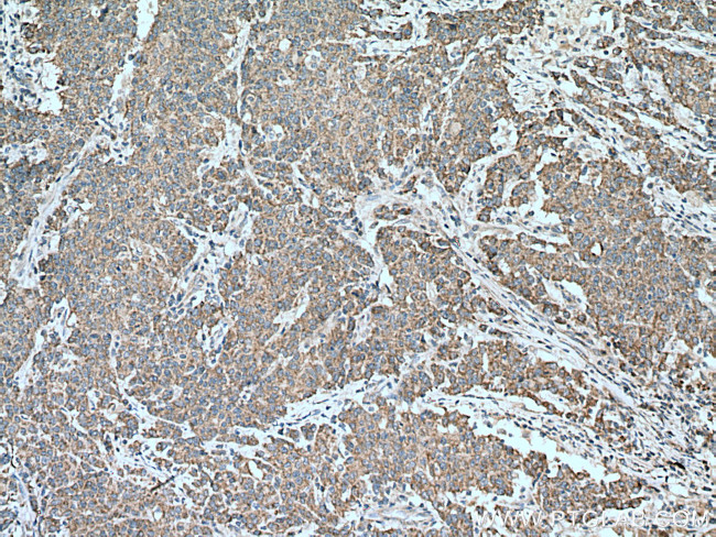MMP17 Antibody in Immunohistochemistry (Paraffin) (IHC (P))