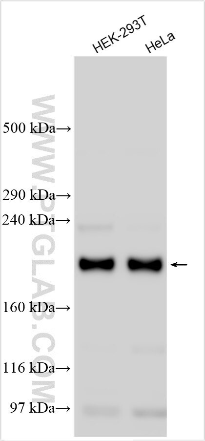 ZC3H13 Antibody in Western Blot (WB)