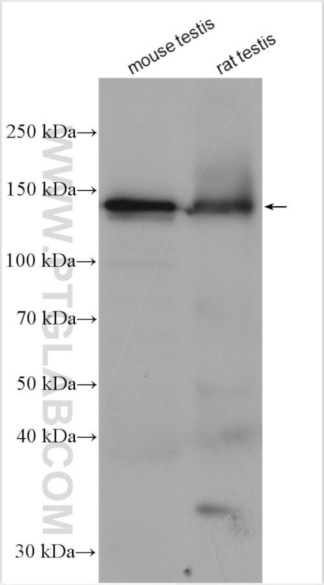 CCDC171 Antibody in Western Blot (WB)