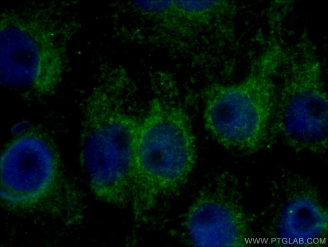 DST Antibody in Immunocytochemistry (ICC/IF)