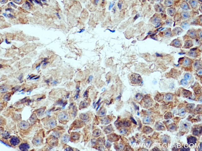 IFT172 Antibody in Immunohistochemistry (Paraffin) (IHC (P))