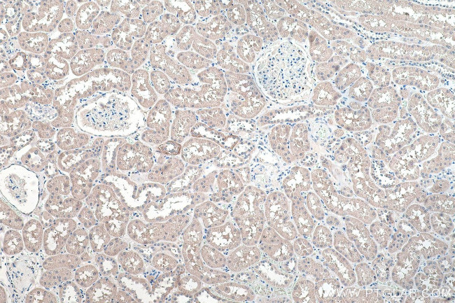 NCX1 Antibody in Immunohistochemistry (Paraffin) (IHC (P))