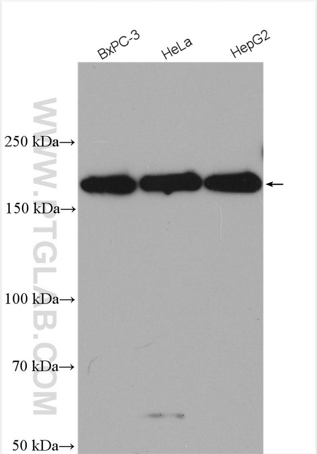 RNF160 Antibody in Western Blot (WB)