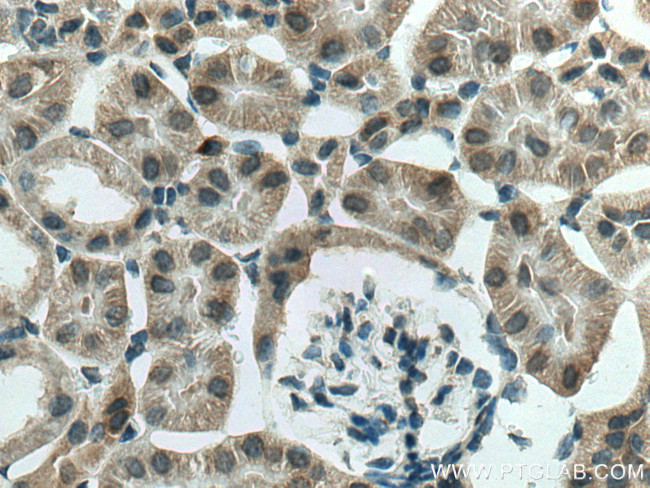 SGK1 Antibody in Immunohistochemistry (Paraffin) (IHC (P))