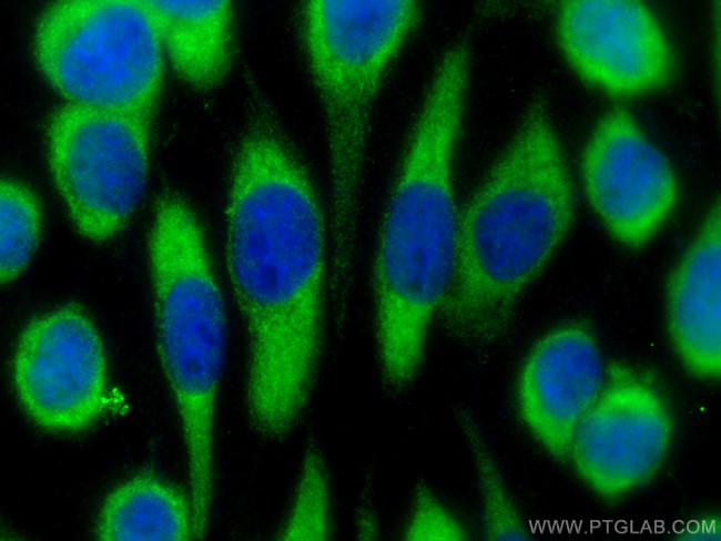 HPF1 Antibody in Immunocytochemistry (ICC/IF)