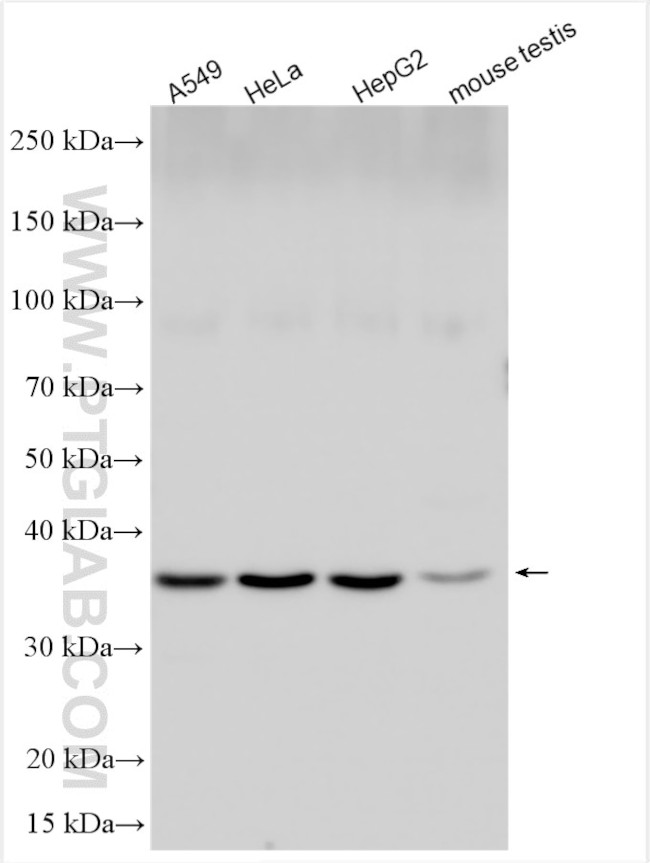 DCPS Antibody in Western Blot (WB)