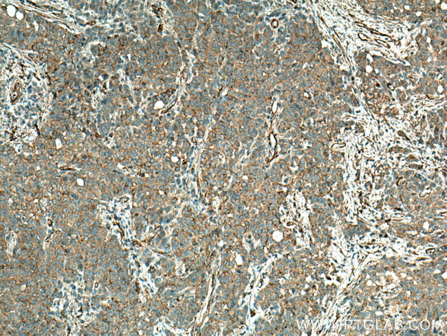 TPM1 Antibody in Immunohistochemistry (Paraffin) (IHC (P))