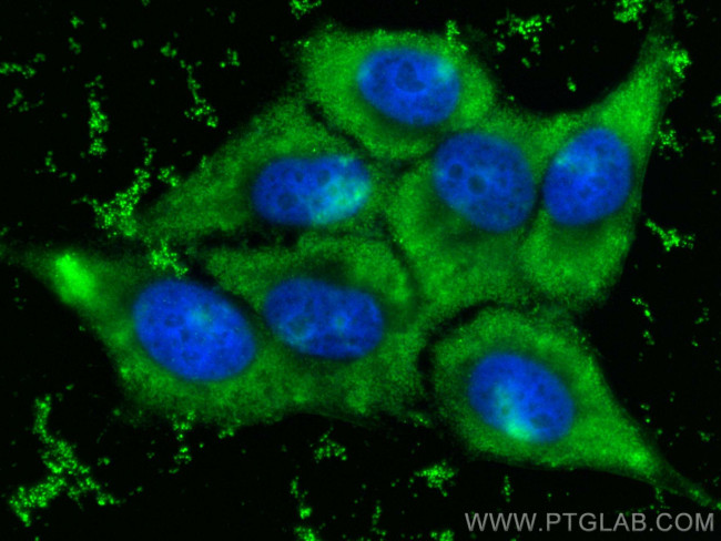 STEAP3 Antibody in Immunocytochemistry (ICC/IF)