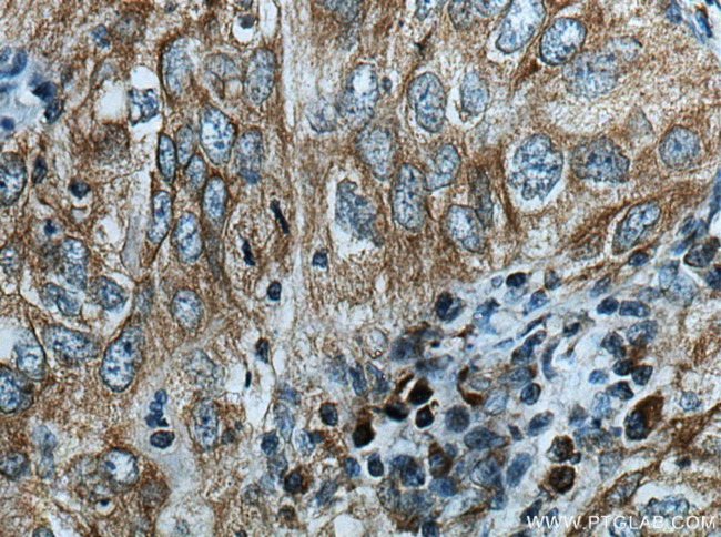 GRP Antibody in Immunohistochemistry (Paraffin) (IHC (P))
