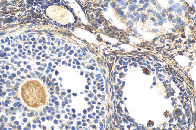 DDIT4L Antibody in Immunohistochemistry (Paraffin) (IHC (P))