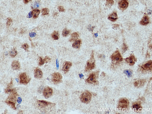 CRBN Antibody in Immunohistochemistry (Paraffin) (IHC (P))