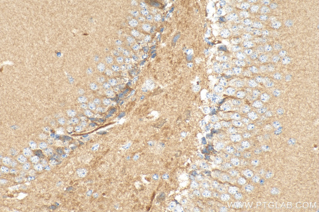 SCN8A Antibody in Immunohistochemistry (Paraffin) (IHC (P))