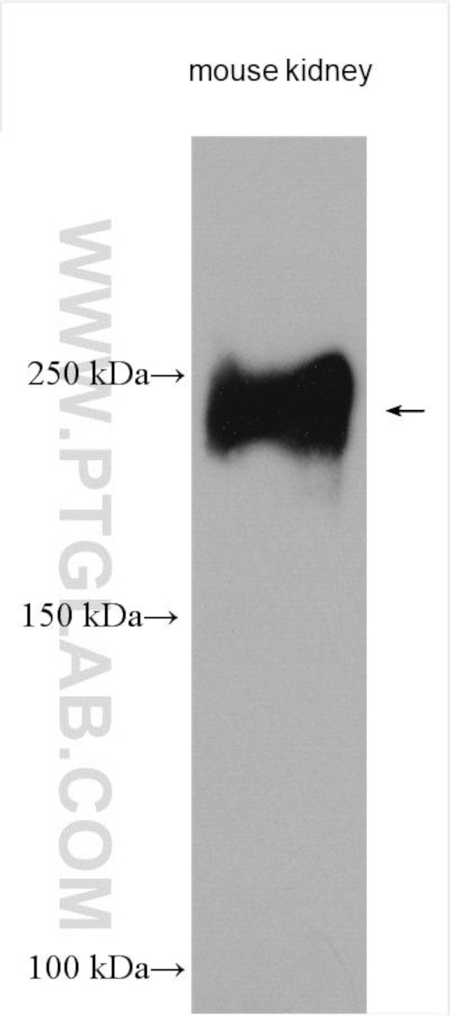 THSD7A Antibody in Western Blot (WB)