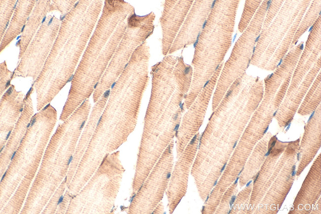FBXO32 Antibody in Immunohistochemistry (Paraffin) (IHC (P))