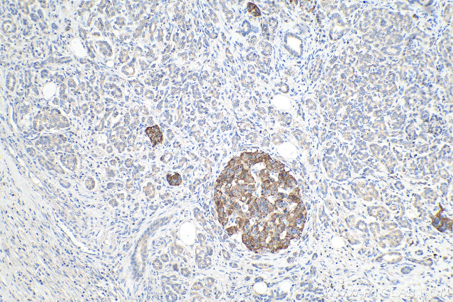 Midkine Antibody in Immunohistochemistry (Paraffin) (IHC (P))