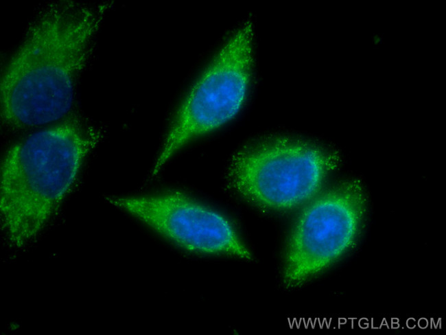 Alpha-2-antiplasmin Antibody in Immunocytochemistry (ICC/IF)