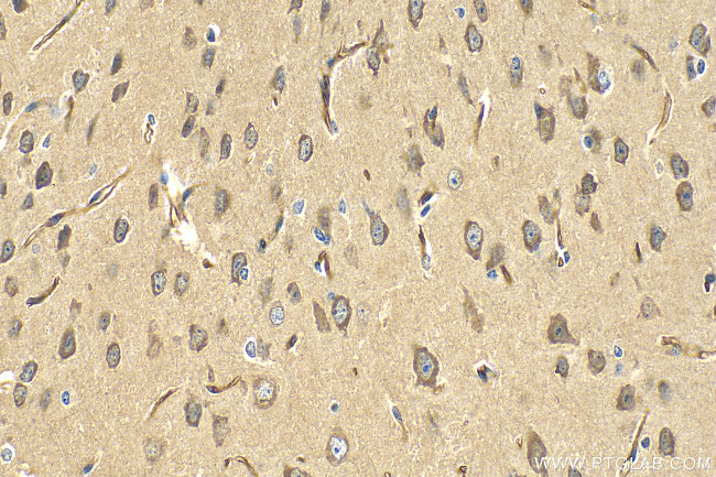GRIK5 Antibody in Immunohistochemistry (Paraffin) (IHC (P))