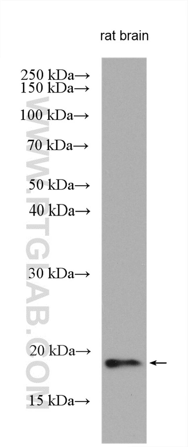 RSPO4 Antibody in Western Blot (WB)