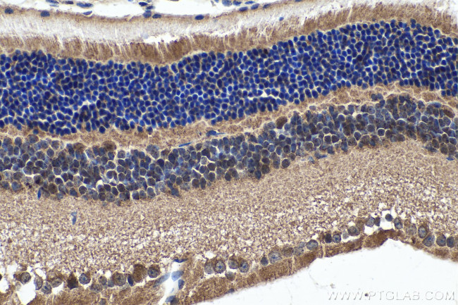 MYO3A Antibody in Immunohistochemistry (Paraffin) (IHC (P))