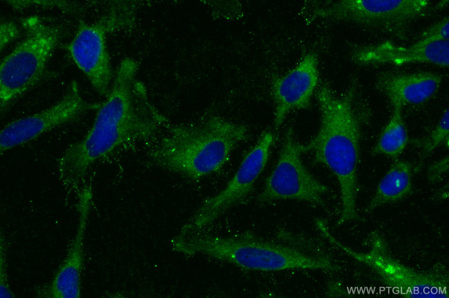 MATN1 Antibody in Immunocytochemistry (ICC/IF)
