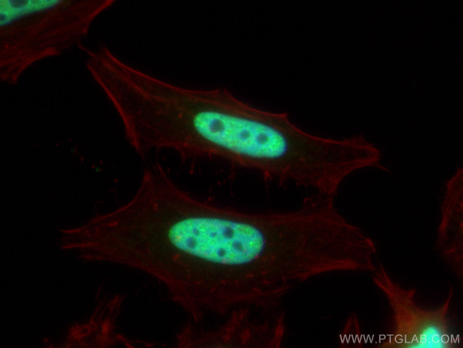 HCFC1 Antibody in Immunocytochemistry (ICC/IF)