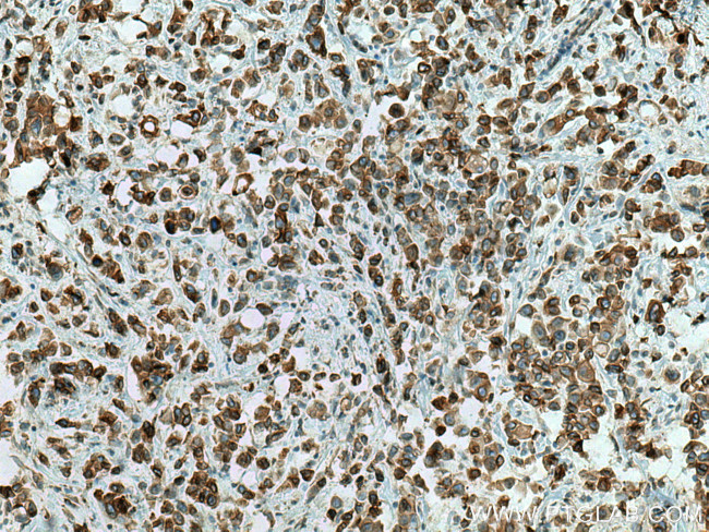 PTPLAD1 Antibody in Immunohistochemistry (Paraffin) (IHC (P))