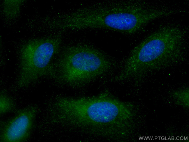 TRIM59 Antibody in Immunocytochemistry (ICC/IF)