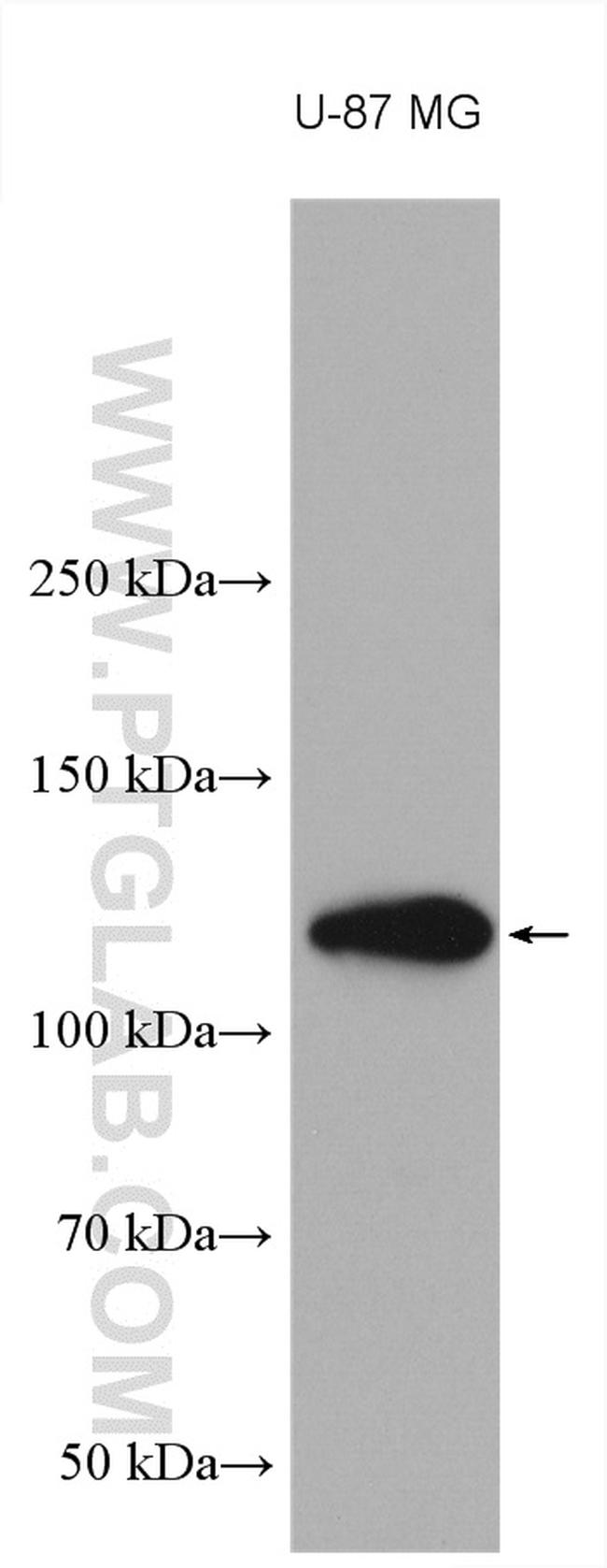 NOTCH2 Antibody in Western Blot (WB)