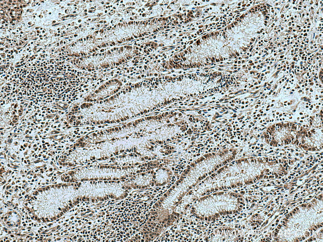 KIF23 Antibody in Immunohistochemistry (Paraffin) (IHC (P))