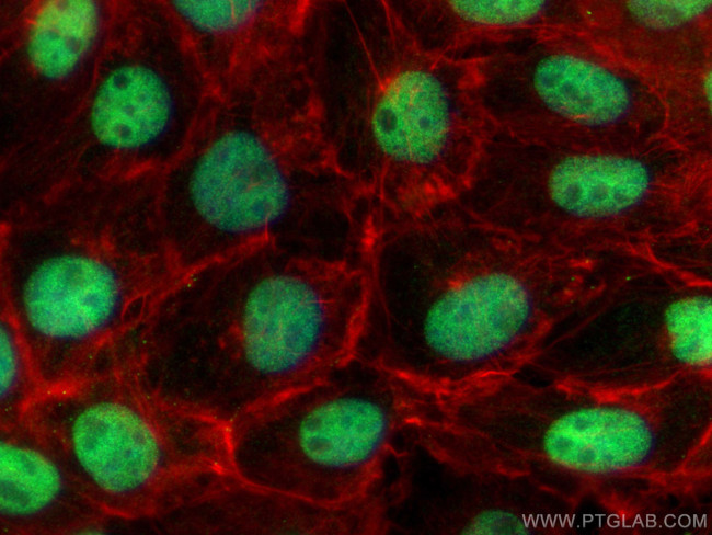 POLQ Antibody in Immunocytochemistry (ICC/IF)