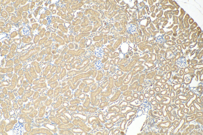 TMEM200C Antibody in Immunohistochemistry (Paraffin) (IHC (P))