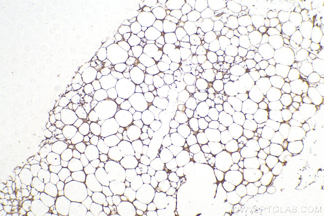 LPL Antibody in Immunohistochemistry (Paraffin) (IHC (P))