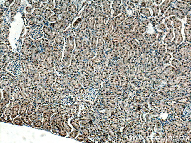 ZBTB8OS Antibody in Immunohistochemistry (Paraffin) (IHC (P))