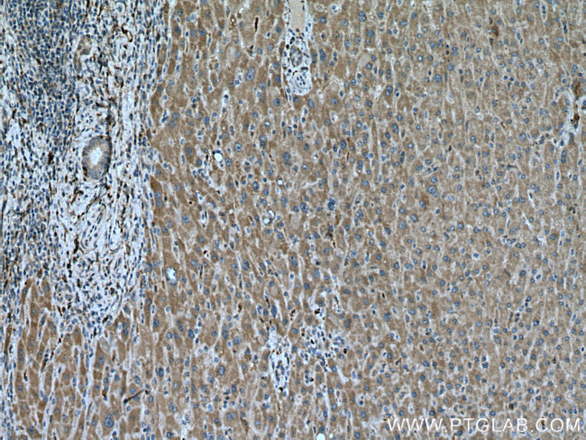 BCAT1 Antibody in Immunohistochemistry (Paraffin) (IHC (P))