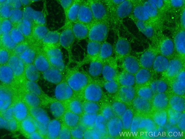 SARM1 Antibody in Immunocytochemistry (ICC/IF)