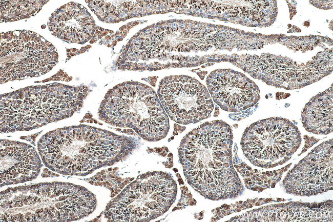 XPO5 Antibody in Immunohistochemistry (Paraffin) (IHC (P))