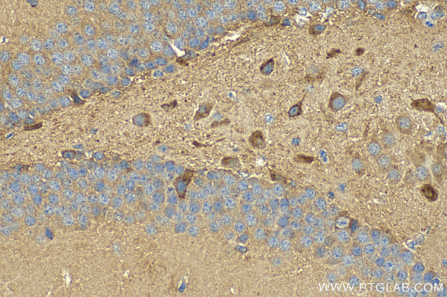 SLC38A1 Antibody in Immunohistochemistry (Paraffin) (IHC (P))