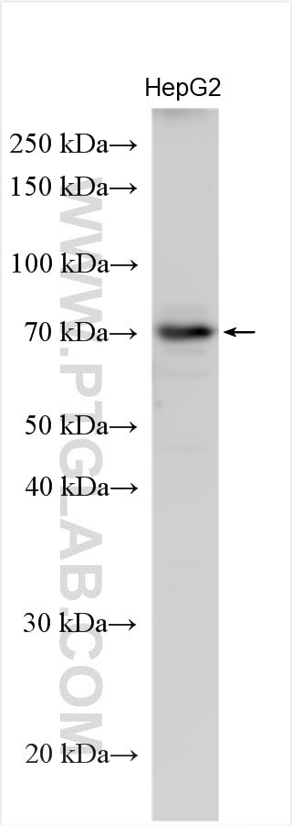CCDC60 Antibody in Western Blot (WB)