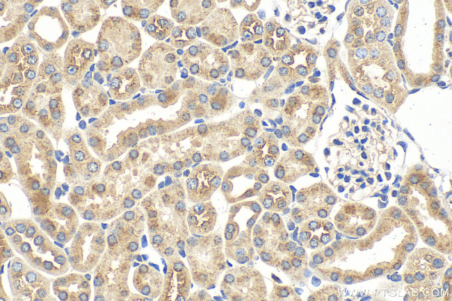 VPS33B Antibody in Immunohistochemistry (Paraffin) (IHC (P))